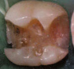 Intarsio: inizio preparazione