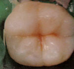 Intarsio: risultato finale