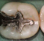 Intarsio: situazione iniziale