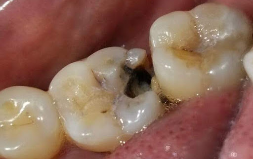 Odontoiatria Conservativa - picture by Ickyvickywiki, CC BY-SA 4.0 Odontoiatria Conservativa